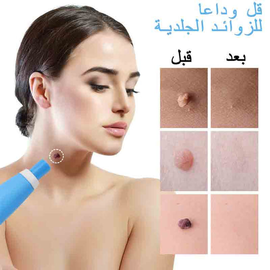 مزيل الزوائد الجلدية